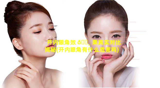 开内眼角效 🕸 果真实对比揭秘(开内眼角有什么危害吗)